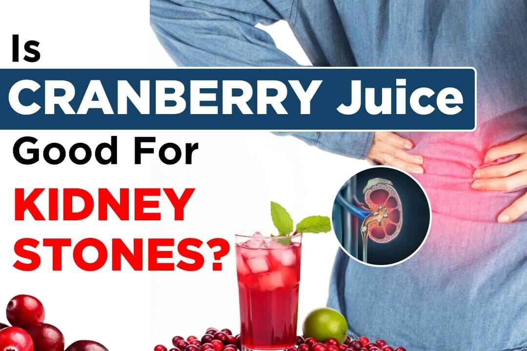 Is Cranberry Juice Good For Kidney Stones?